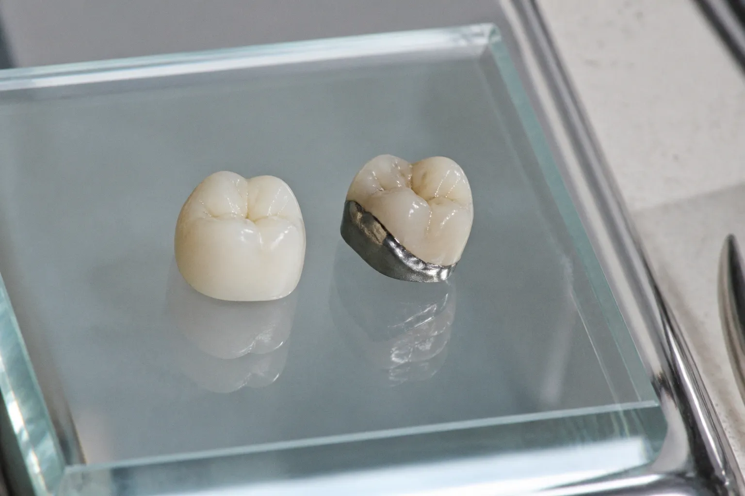 Zirkonoxid oder Metallkeramik: Welcher Zahnersatz überzeugt